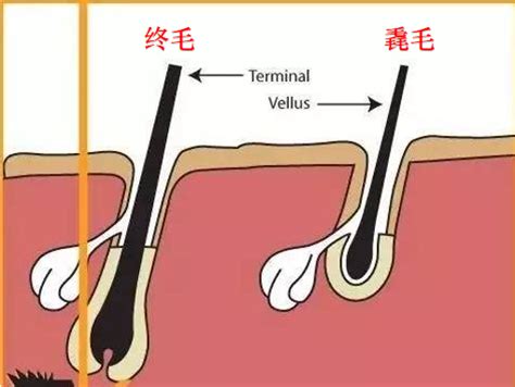 癦生毛|毳毛是什么原因造成的